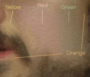 Color zones in my face Color zones in my face
